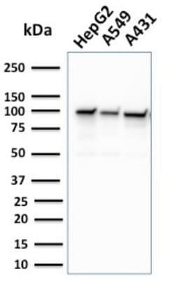 MSH2 Antibody (MSH2/2622) - Azide and BSA Free, Novus Biologicals 100 &mu;g;